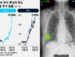 '암 정복의 꿈' 타고 3만원→11만원..300% 급등한 의료AI株 열풍