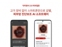라이프시맨틱스 "피부암 영상검출·진단보조 SW 확증 임상 성공적 완료"