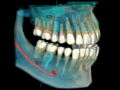 "ġ Ȯ δ", 3D ġƺи  AI  ȭ