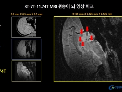 ġ  ܹ, 3 ׿ MRI  δ