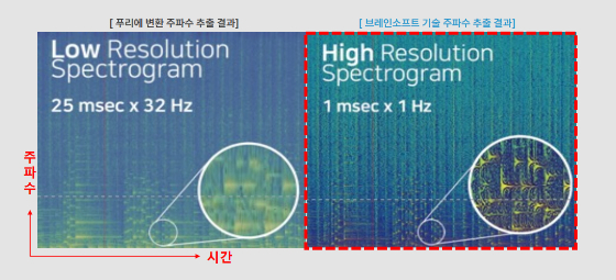 브레인소프트, 산자부 국책과제 추진…저전력 보청기용 SoC 개발 나서 - 뉴스 썸네일 이미지