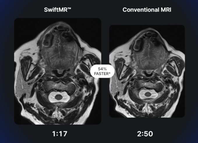 의료·물류부터 팹리스·전력반도체까지, 기관들이 투자한 AI 스타트업은... - 뉴스 썸네일 이미지