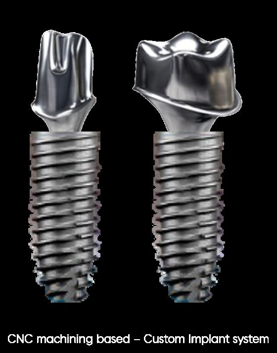 시리즈벤처스, 임플란트 상부 구조물 제조기업 '덴티플'에 투자 - 뉴스 썸네일 이미지