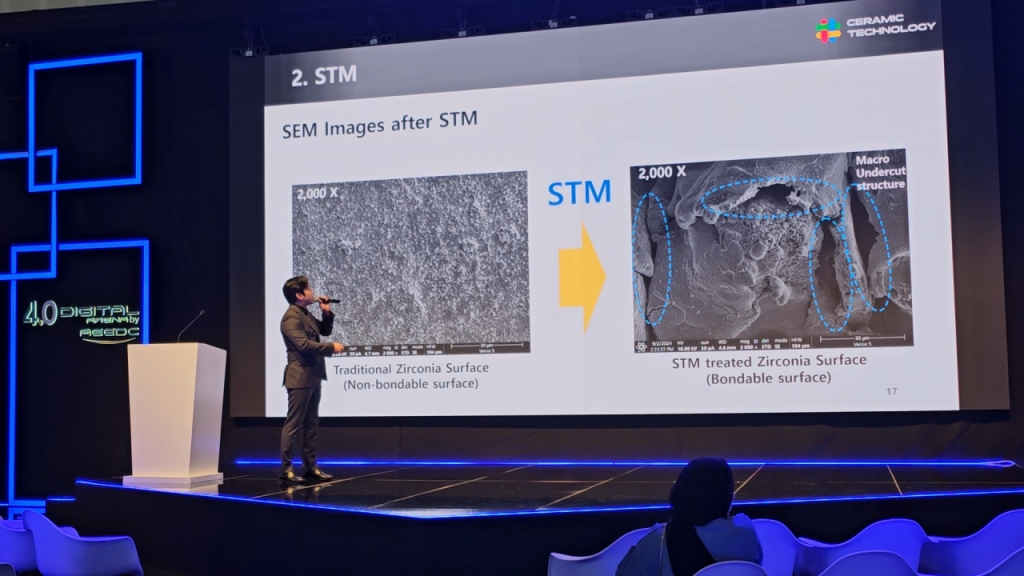 바이오세텍, 접착력 높인 치과 보철 장비 'STM' 판매 본격화 - 뉴스 썸네일 이미지