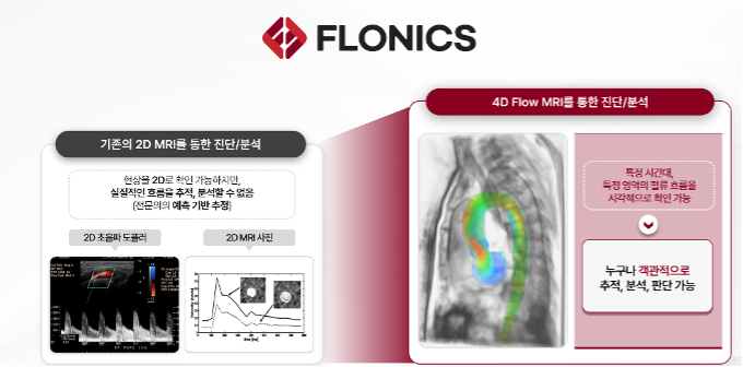 의사·교수가 합심해 일냈다...혈류 분석 AI 솔루션에 뭉칫돈 - 뉴스 썸네일 이미지