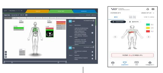 시리즈벤처스, AI 건강·의료아바타 '비주얼터미놀로지'에 시드 투자 - 뉴스 썸네일 이미지