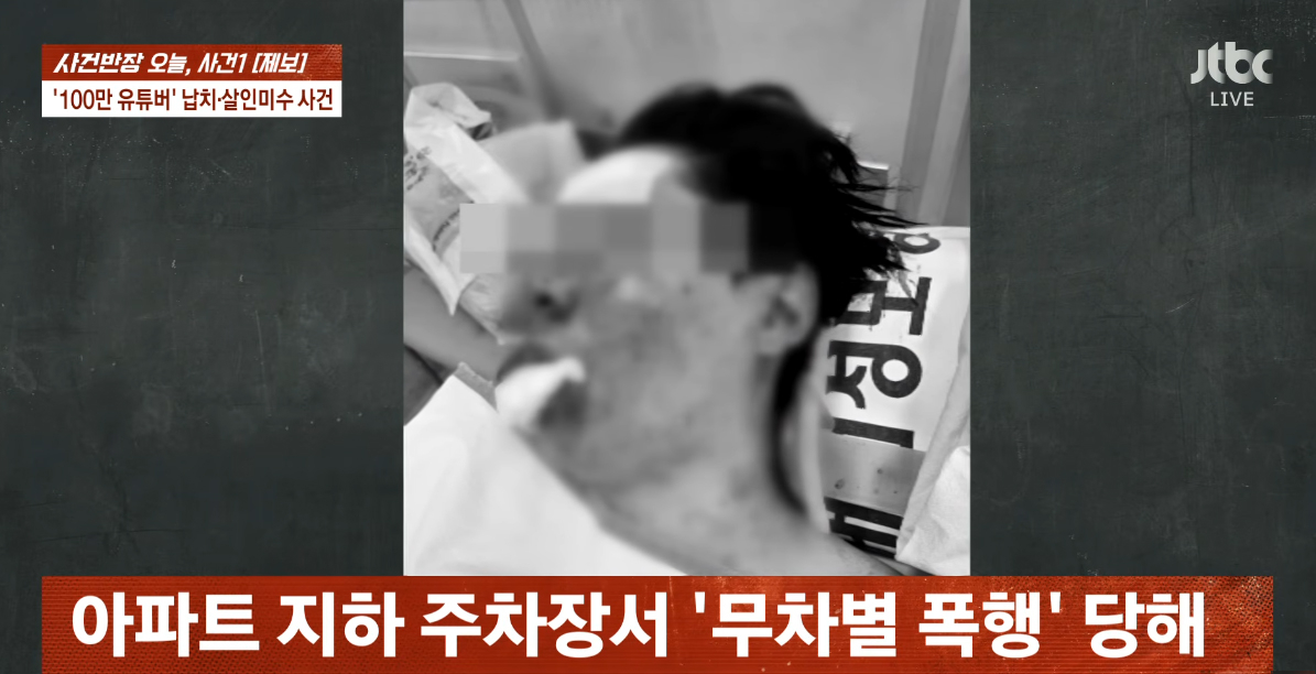 폭행 피해 사진