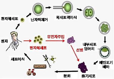 ↑체세포 유래 다능성 줄기세포(iPS)를 이용한 환자맞춤형세포치료 모식도 모습. 검은색 화살표는 난자를 사용한 체세포핵이식방법이고, 빨간색 화살표가 난자를 사용하지 않는 iPS 방법이다.