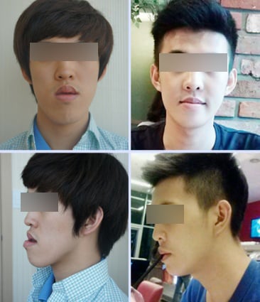 <렛미인2>의 닥터스 중 이상우 원장의 철저한 가이드 안에서 이루어진 백승오씨의 새로운 변신.