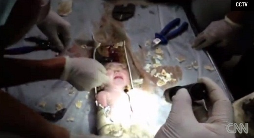 중국 저장성 소방 대원들이 25일 하수관에서 발견된 아기를 구출하는 모습. /사진=CNN 동영상 캡처