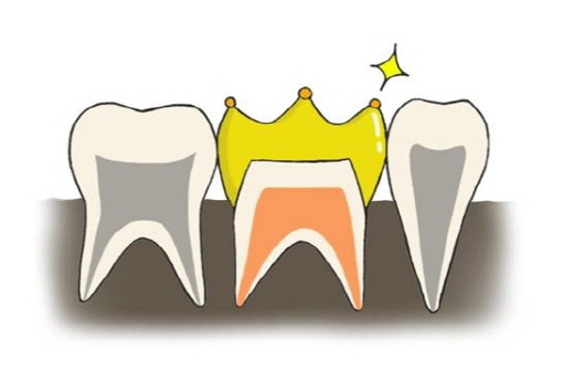 /삽화=김효정 치위생사(임플란티아 치과 삼성점)