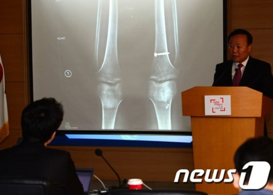 김재원 새누리당 의원이 24일 오후 서울 세종로 정부서울청사 브리핑룸에서 이완구 국무총리 내정자 차남의 병역 면제 판정 관련 엑스레이 필름 자료를 공개하고 있다.  /뉴스1