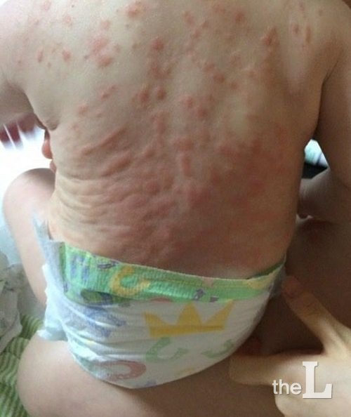 피해아동/사진=피해자들이 개설한 인스타그램