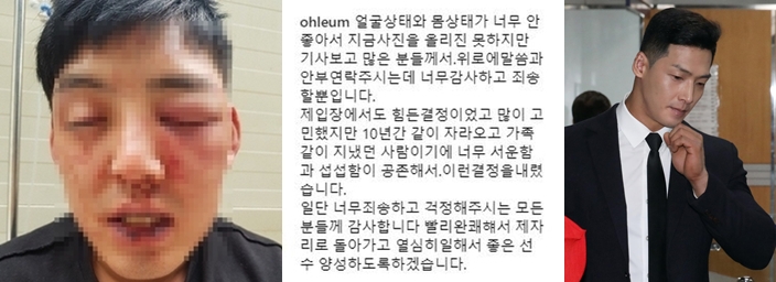 양호석에게 폭행당한 차오름이 당시 올린 피해 사진과 글(왼쪽), 양호석이 9일 오전 서울 서초구 서울중앙지방법원에서 열린 상해 1차 공판에 출석하고 있다./사진=차오름 SNS(왼쪽), 뉴스1