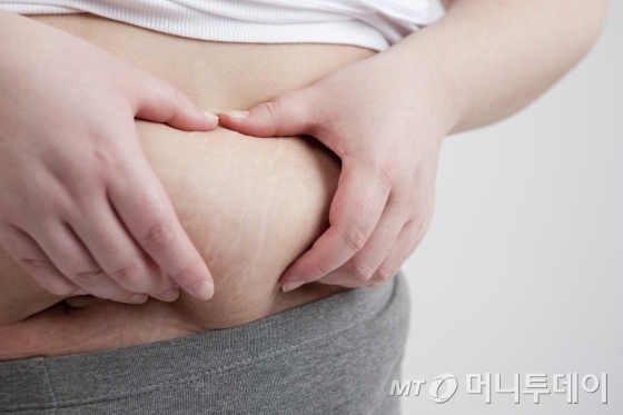 비만 / 사진제공=이미지투데이