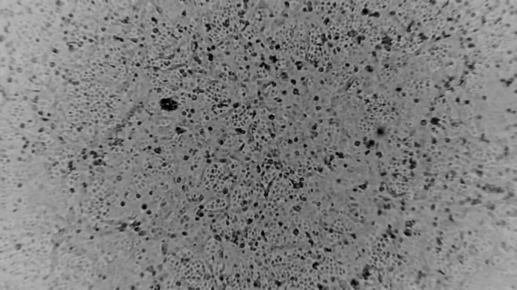 코로나19(신종 코로나바이러스) /사진=로이터