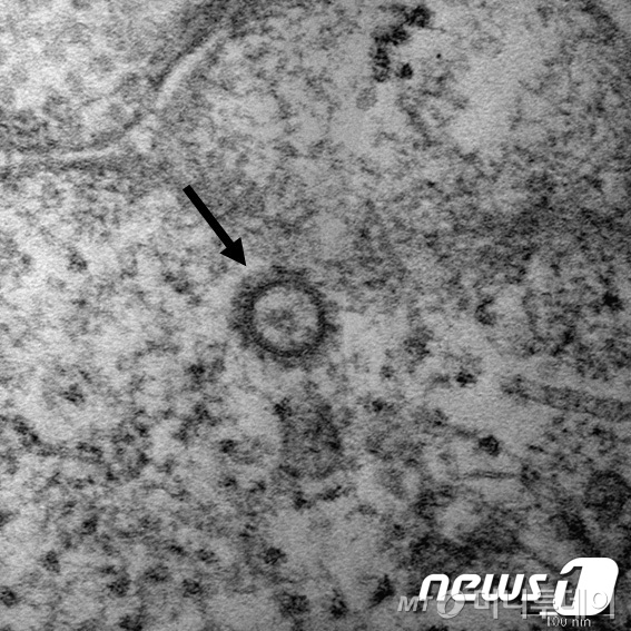 질병관리본부가 지난달 27일 6명의 코로나19 환자로부터 얻은 바이러스 유전자를 분석한 결과와 고해상 전자현미경 사진을 공개했다. 질병관리본부 분석결과 바이러스가 인체에 침입하는데 중요한 역할을 하는 세포결합부위, 바이러스 증식과 병원성 등을 담당 하는 유전자 부위에서 아직까지 변이가 발견되지는 않았다. (질병관리본부 제공) /사진=뉴스1