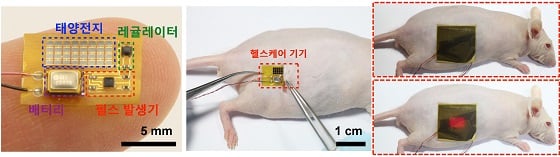 (좌측) 태양전지가 통합된 삽입형 유연성 헬스케어 기기 사진, (가운데) 헬스케어 기기를 피하에 삽입하는 사진, (우측) 마이크로LED 패치를 부착하여 삽입된 헬스케어기기에 전력을 공급하는 사진/자료=GIST