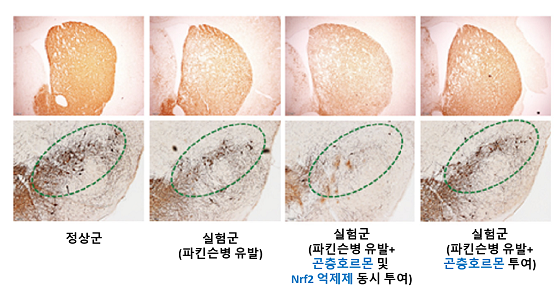 그림4. Nrf 억제제를 활용한 곤충호르몬의 항파킨슨 효능 기전 확인 결과단독 투여 시 도파민 세포 보호 효능을 보인 곤충호르몬(20-하이드록시엑디손)을 Nrf2억제제(ML385)와 동시 투여했을 때는 해당 효능이 나타나지 않았다. 이에, 곤충호르몬이 Nrf2를 활성해 파킨슨병 증상을 개선한다는 것을 확인했다/자료=한의학연
