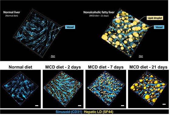 비알콜성지방간(Nonalcoholic fatty liver)단계에서 지방구(황색)축적을 보여주는 3차원 생체현미경 영상 결과물/사진=KAIST