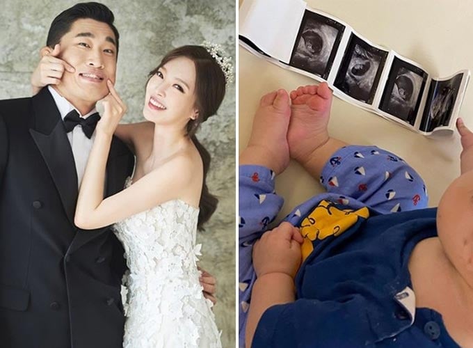김동현 송하율 부부, 초음파 사진을 바라보는 김동현 송하율 부부의 아들 단우/사진=본부이엔티, 송하율 인스타그램