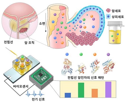 반도체 기반의 초고감도 바이오센서를 활용하여 환자 소변에서 극미량의 암인자들을 검출하고, 여기서 발생하는 검출 신호의 패턴을 얻어냄/자료=KIST