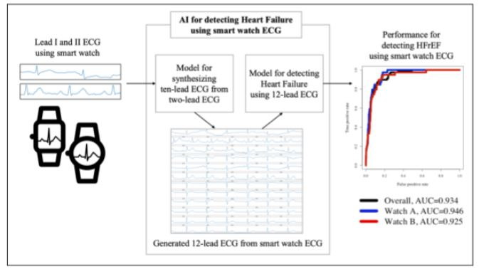 ECG(심전도) 측정값과 AI로 심부전을 측정하는 모델 요약 자료/사진제공=메디컬AI