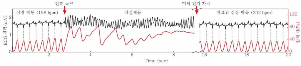 기초과학연구원(IBS) 연구팀이 개발한 전자패치의 전임상시험 그래프. / 사진제공=기초과학연구원(IBS)