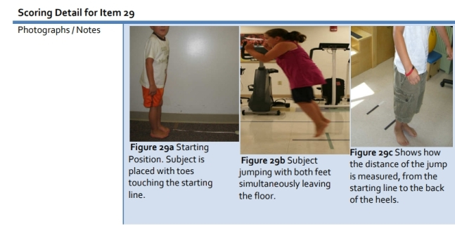 치료제를 계속 맞으려면 시험을 봐야 한다. 치료가 효과가 있단 걸 환자 스스로 계속 증명해야 하는 거다. 그 척도 중 하나가 해머스미스 평가 기준이다. 사진은 이중 하나인 '뛰기'. 어느 정도를 뛰는지에 따라 점수를 0점, 1점, 2점으로 나눠 매긴다. 문제는 척수성근위축증이 일찍 발병한 '1형 환자' 등은 이 동작을 사실상 하기 어렵단 거다./사진=해머스미스 평가 기준