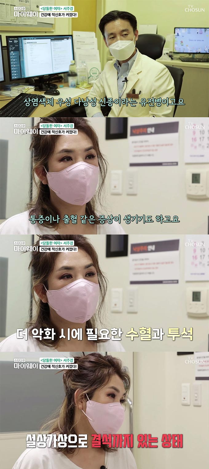 /사진=TV조선 '스타다큐 마이웨이' 방송 화면