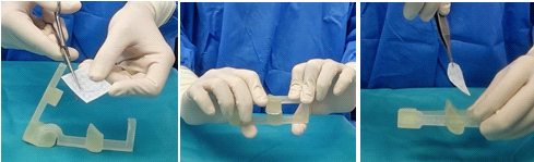 3D프린팅 안와골절 가이드를 이용해 골절 부위에 넣을 임플란트를 만드는 모습./사진=건국대병원 