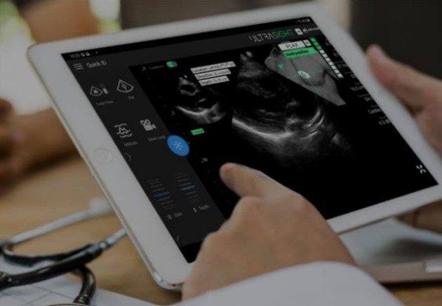 울트라사이트가 제작한 인공지능 심장초음파검사 소프트웨어를 태블릿 컴퓨터로 조작하는 모습. /사진제공=울트라사이트.