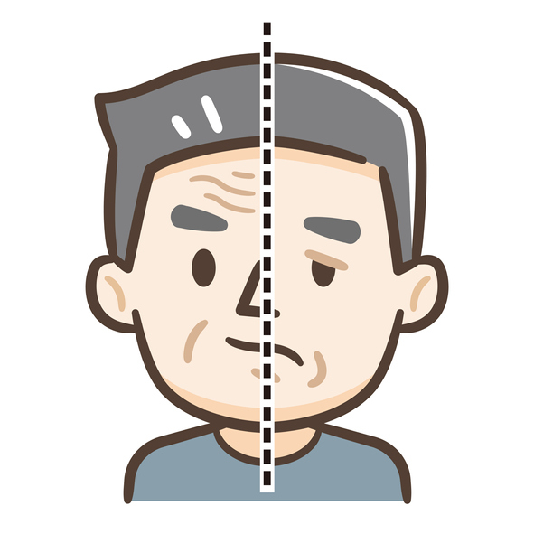  말초성 안면마비 환자는 한쪽 얼굴 전체가 마비돼 이마 주름을 잡을 수 없다. 반면 뇌 문제로 인한 중추성 안면마비 환자는 이마에 주름을 잡을 수 있으면서 아래쪽 얼굴에만 마비가 발생한다는 특징이 있다.