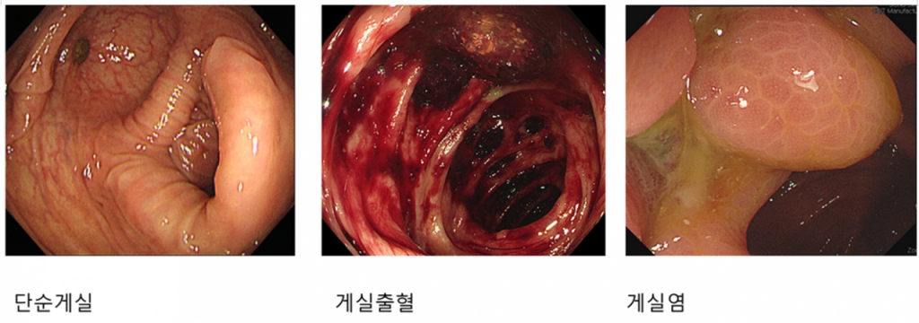 /사진=이태희 순청향대서울병원 교수