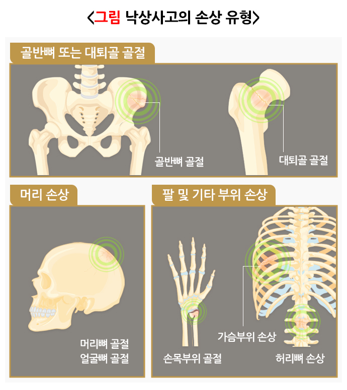 낙상사고로 인한 부위별 손상 유형. /그림=질병관리청