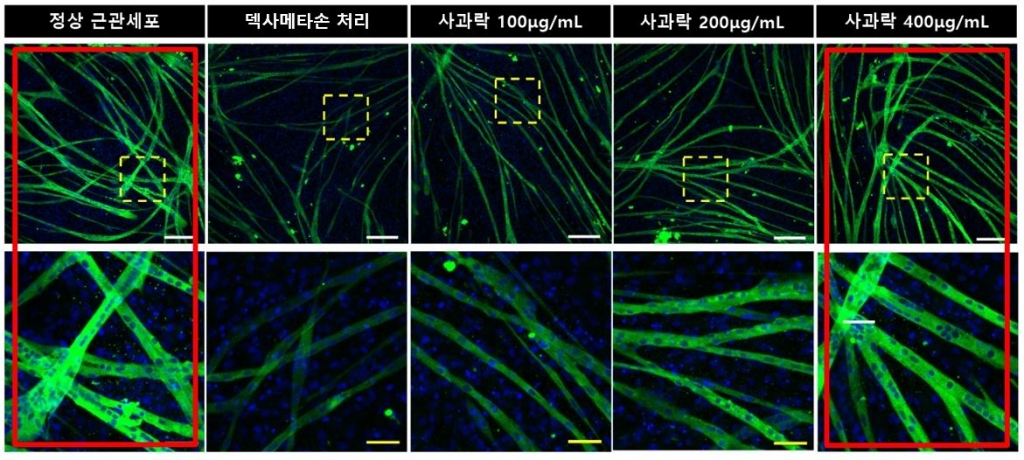 사과락 농도가 높을수록 근관세포의 크기·수가 정상에 가깝게 회복됐다. /사진=자생한방병원 