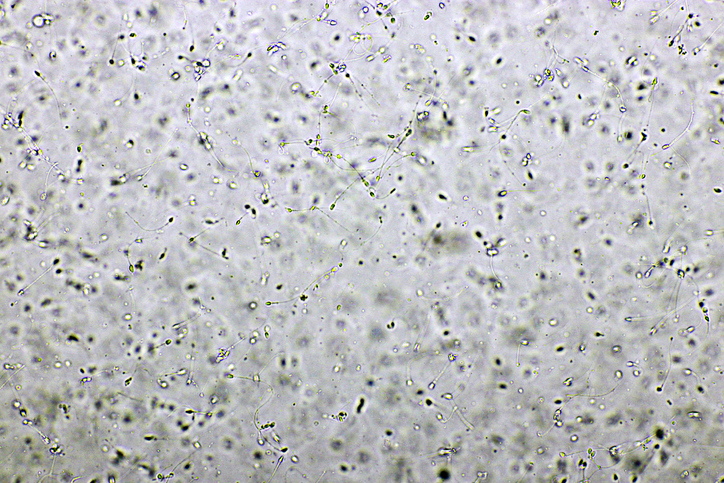 정액을 채취해 얻은 정자들.