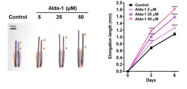 인간 모낭 기관배양 모델에서 ALDH2 활성화제(Alda-1) 처리 후 성장한 머리카락의 길이 비교. /자료=서울대병원