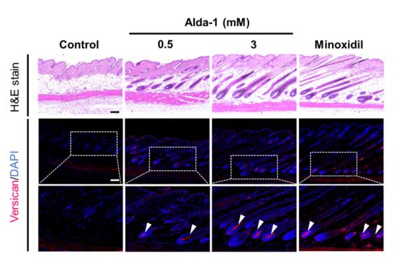 동물실험에서 ALDH2 활성화제(Alda-1)를 처리한 후 머리카락의 성장기 진입을 유도했다. /자료=서울대병원
