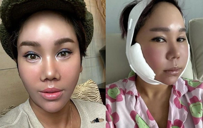 /사진=김송 인스타그램