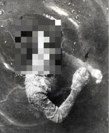 마산 앞바다에서 발견된 김주열 군의 시신/출처=한국민족문화대백과, 부산일보 등