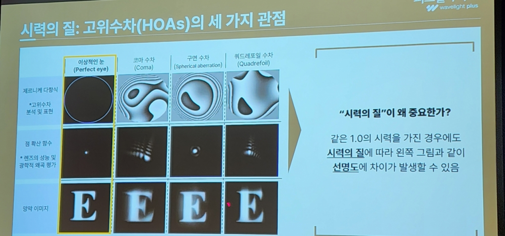 이날 최성호 퍼스트삼성안과 대표원장은 "시력이 1.0이어도 '시력의 질'에 따라 알파벳 'E'를 볼 때 선명도에 차이가 클 수 있다"며 "시력교정술을 통해 단순히 시력을 높이는 것뿐 아니라 시력의 질도 함께 개선하는 게 중요하다"고 설명했다. 사진은 해당 발표의 자료 화면. /사진=정심교