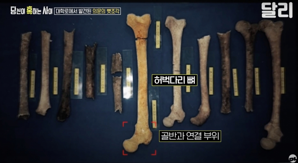 국과수는 경찰로부터 의뢰받은 후 약 4개월에 걸친 정밀 조사 끝에 감식 결과를 발표했다. 유골이 과거 경성제국대학 의학부에서 해부 실습을 한 후 유기한 시신이라는 내용이었다./사진=달리 유튜브 채널