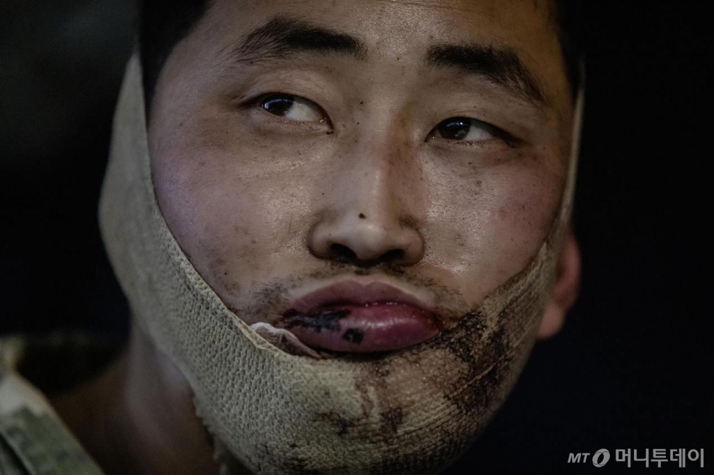 볼로디미르 젤렌스키 우크라이나 대통령이 지난 11일 생포된 북한군 2명의 모습을 담은 사진을 SNS를 통해 공개했다. 사진은 얼굴에 부상당한 북한군. / 사진=뉴시스