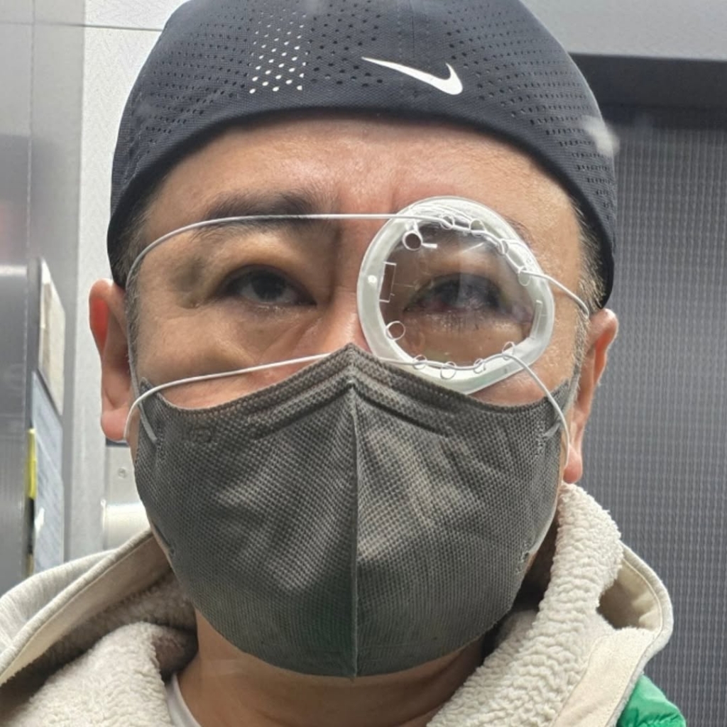 배우 이광기는 지난 3일 자신의 인스타그램에 망막박리 수술을 받았다고 밝혔다. /사진=이광기 인스타그램