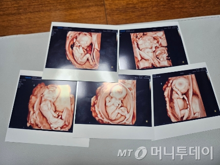 (서울=뉴스1) = 지난 20일 동두천시에 거주하는는 교육공무원 부부가 자연임신한 다섯 쌍둥이 출산에 성공했다.   가톨릭대 서울성모병원은 남아 3명과 여아 2명 분만을 성공리에 마쳤다고 밝혔다. (서울성모병원 제공) 2024.9.21/뉴스1  Copyright © 뉴스1. All rights reserved. 무단 전재 및 재배포,  AI학습 이용 금지. /사진=(서울=뉴스1)