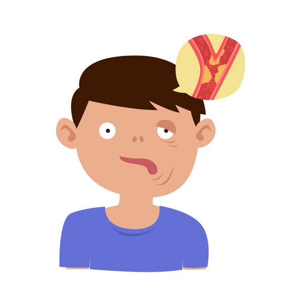 얼굴 한쪽이 마비되고 발음이 어눌해졌다면 뇌졸중을 의심해볼 수 있다. 