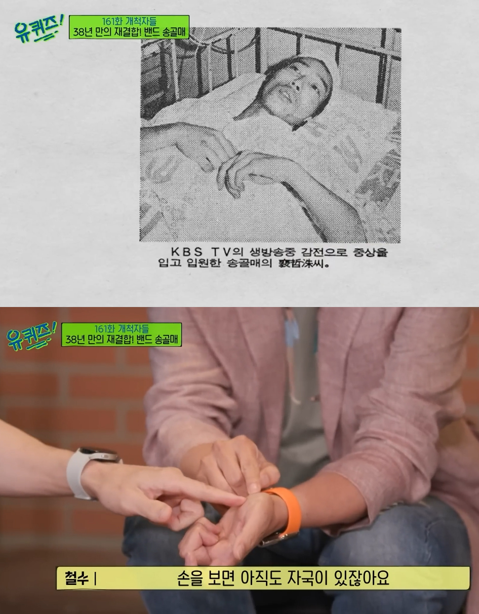 가수 배철수가 감전사고로 남은 흉터를 공개했다. /사진=tvN '유 퀴즈 온 더 블럭' 방송화면