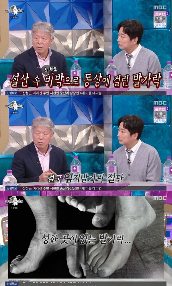 산악인 엄홍길이 지난 26일 방송된 MBC 예능 '라디오스타'에 출연해 발 사진을 공개했다. /사진=MBC 예능 '라디오스타'