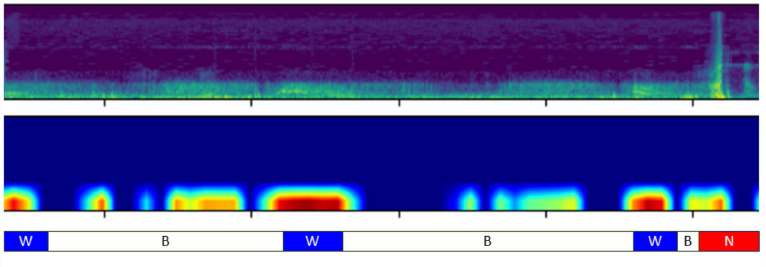  호흡음 분석 변환 모델(AST)로 천명음(W), 정상 호흡(B), 소음(N)을 분석하는 장면./사진=분당서울대병원